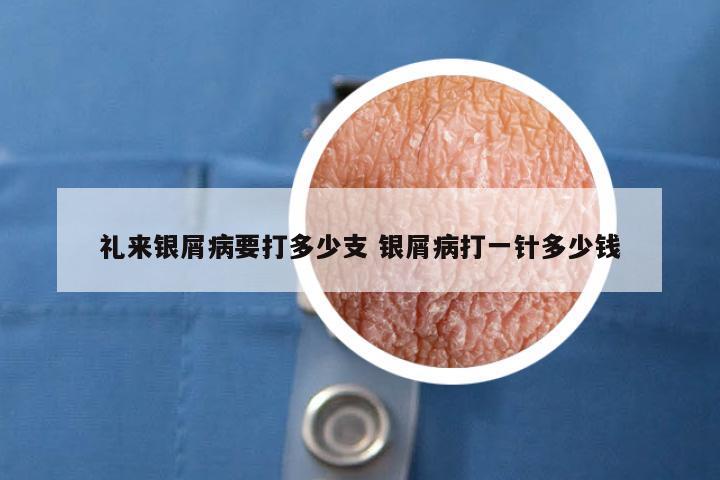 礼来银屑病要打多少支 银屑病打一针多少钱