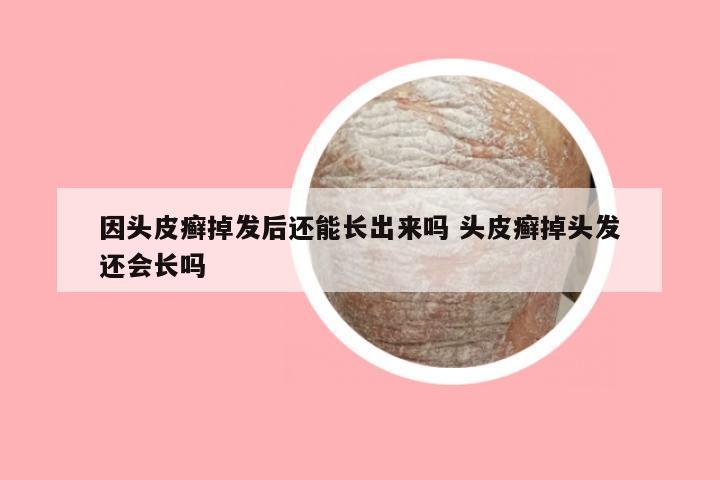 因头皮癣掉发后还能长出来吗 头皮癣掉头发还会长吗