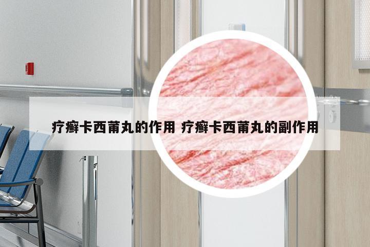 疗癣卡西莆丸的作用 疗癣卡西莆丸的副作用