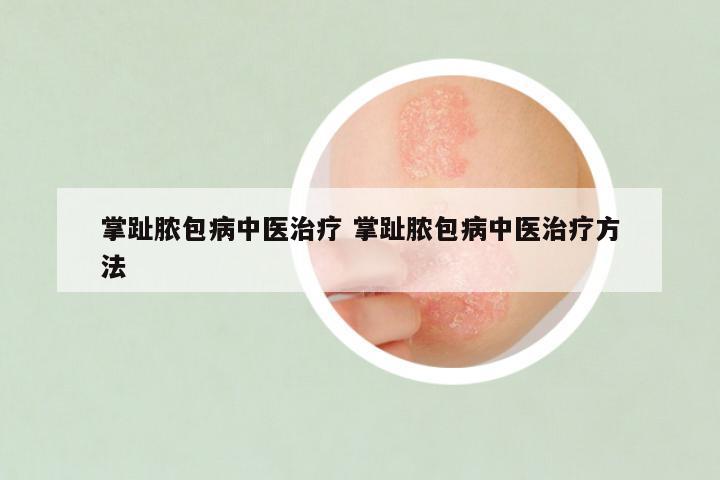 掌趾脓包病中医治疗 掌趾脓包病中医治疗方法
