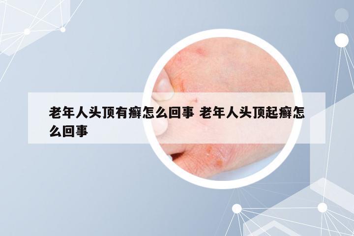 老年人头顶有癣怎么回事 老年人头顶起癣怎么回事