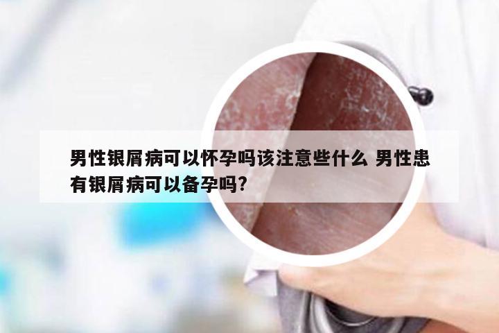 男性银屑病可以怀孕吗该注意些什么 男性患有银屑病可以备孕吗?