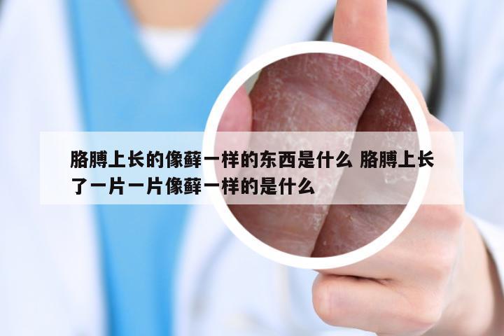 胳膊上长的像藓一样的东西是什么 胳膊上长了一片一片像藓一样的是什么
