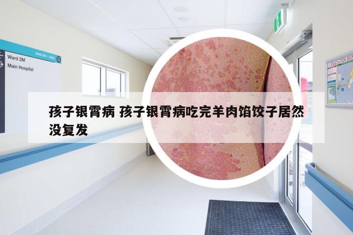 孩子银霄病 孩子银霄病吃完羊肉馅饺子居然没复发