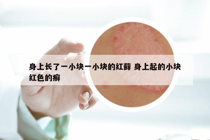 身上长了一小块一小块的红藓 身上起的小块红色的癣