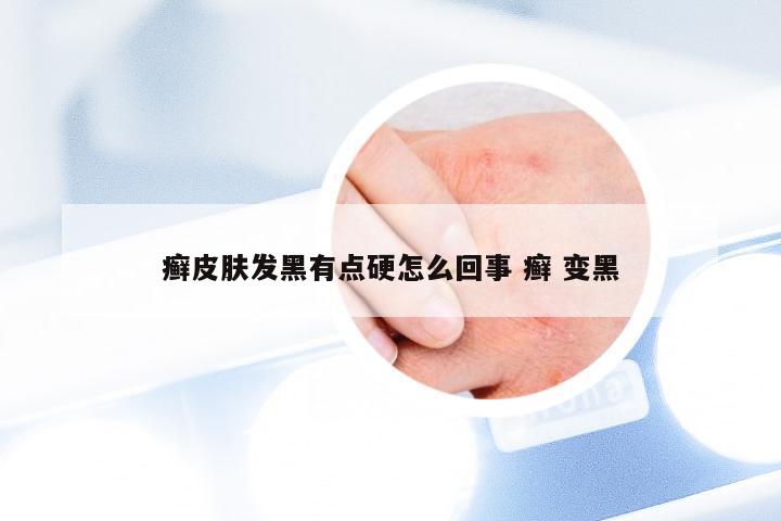 癣皮肤发黑有点硬怎么回事 癣 变黑