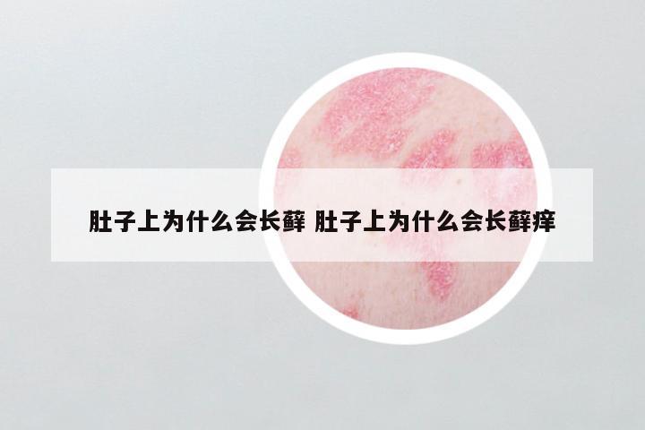 肚子上为什么会长藓 肚子上为什么会长藓痒