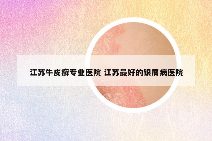 江苏牛皮癣专业医院 江苏最好的银屑病医院