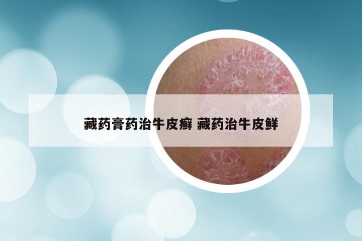 藏药膏药治牛皮癣 藏药治牛皮鲜