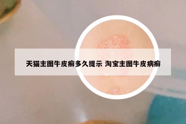 天猫主图牛皮癣多久提示 淘宝主图牛皮病癣
