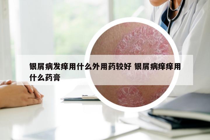 银屑病发痒用什么外用药较好 银屑病痒痒用什么药膏