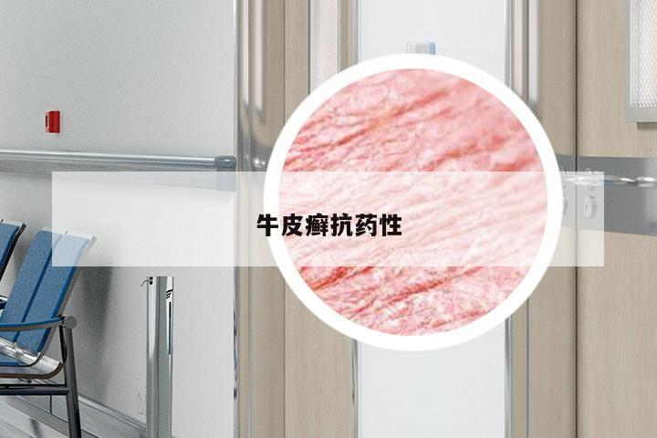 牛皮癣抗药性