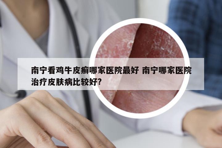 南宁看鸡牛皮癣哪家医院最好 南宁哪家医院治疗皮肤病比较好?