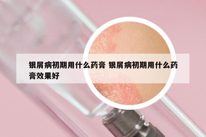 银屑病初期用什么药膏 银屑病初期用什么药膏效果好