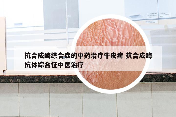 抗合成酶综合症的中药治疗牛皮癣 抗合成酶抗体综合征中医治疗