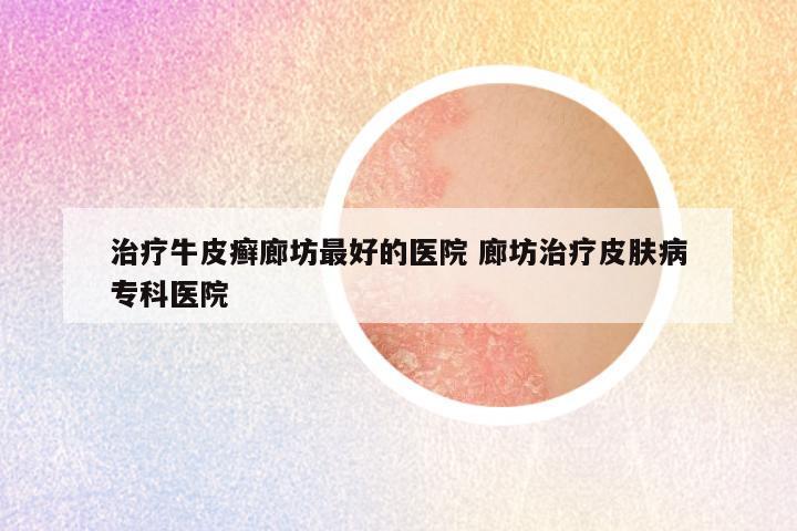 治疗牛皮癣廊坊最好的医院 廊坊治疗皮肤病专科医院