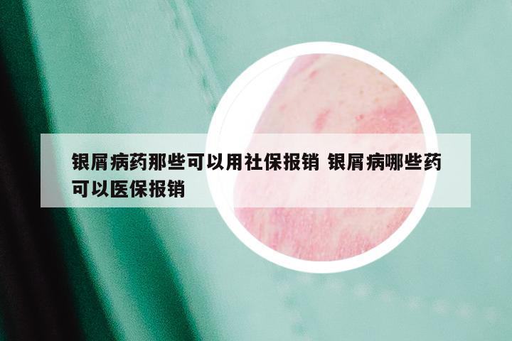 银屑病药那些可以用社保报销 银屑病哪些药可以医保报销