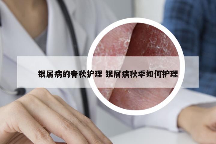 银屑病的春秋护理 银屑病秋季如何护理