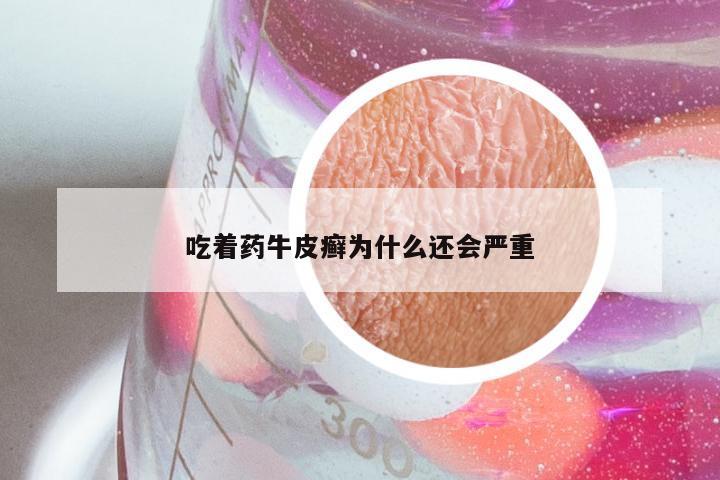 吃着药牛皮癣为什么还会严重
