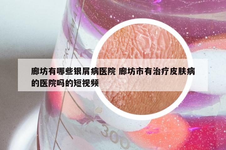 廊坊有哪些银屑病医院 廊坊市有治疗皮肤病的医院吗的短视频