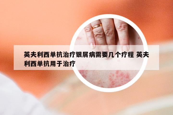 英夫利西单抗治疗银屑病需要几个疗程 英夫利西单抗用于治疗