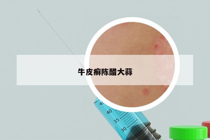 牛皮癣陈醋大蒜