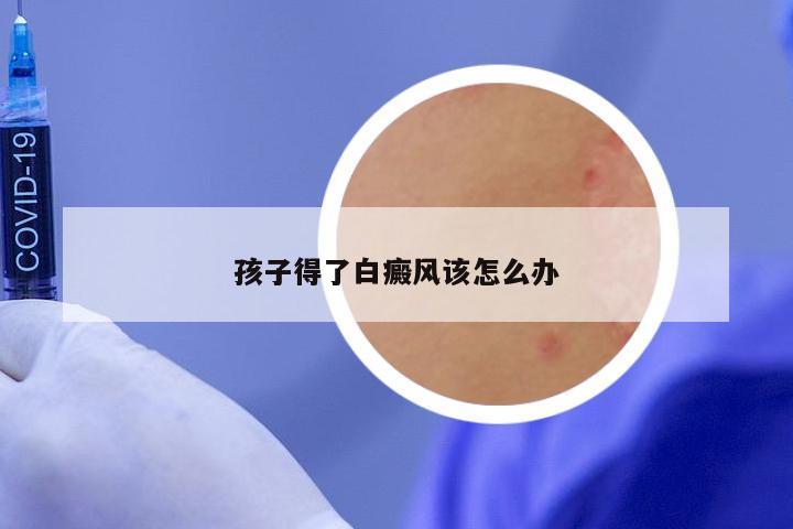 孩子得了白癜风该怎么办