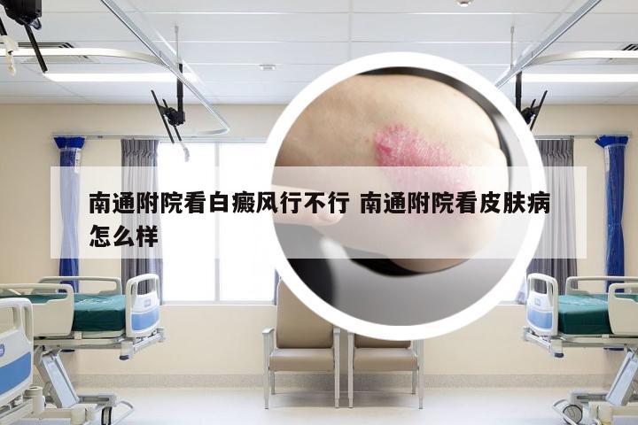 南通附院看白癜风行不行 南通附院看皮肤病怎么样