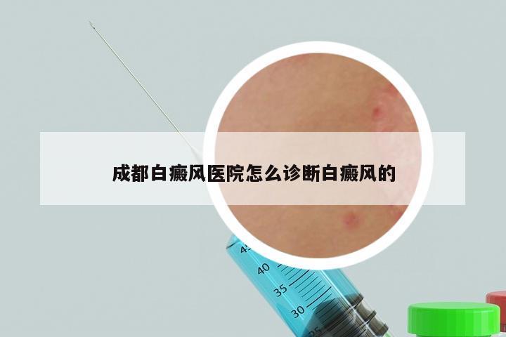 成都白癜风医院怎么诊断白癜风的