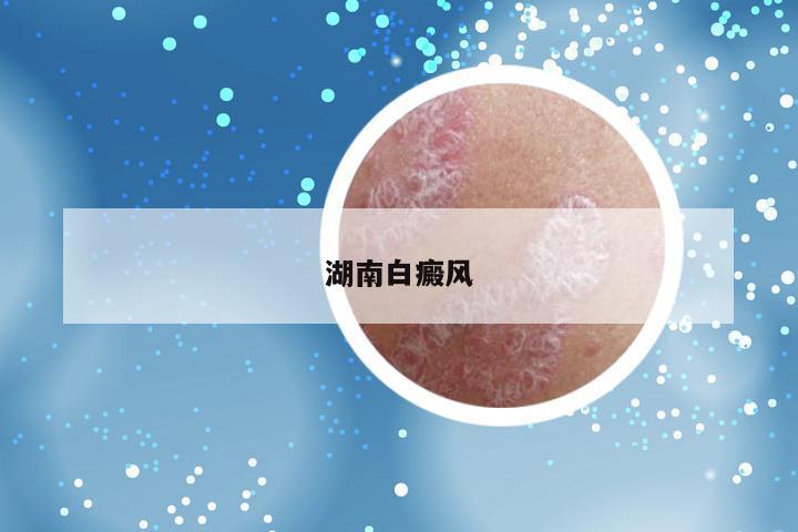 湖南白癜风