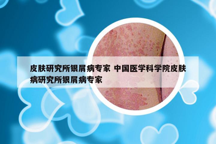 皮肤研究所银屑病专家 中国医学科学院皮肤病研究所银屑病专家