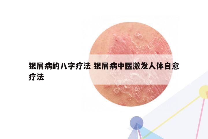 银屑病的八字疗法 银屑病中医激发人体自愈疗法