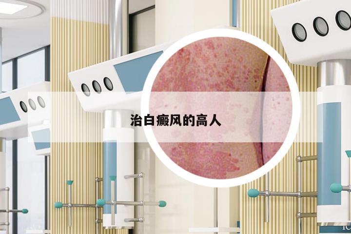 治白癜风的高人