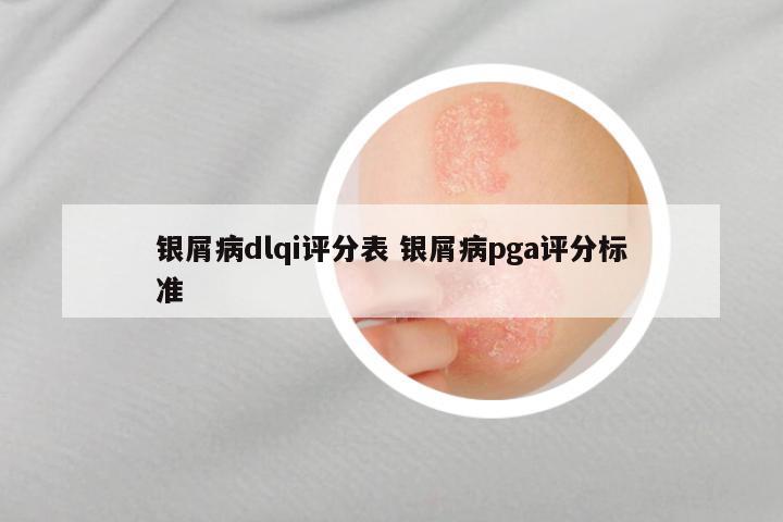 银屑病dlqi评分表 银屑病pga评分标准