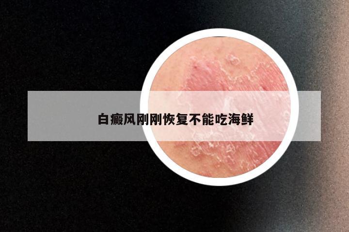 白癜风刚刚恢复不能吃海鲜