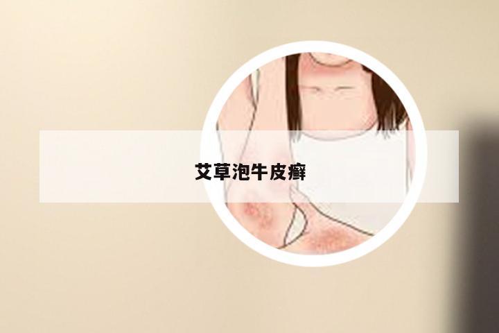 艾草泡牛皮癣