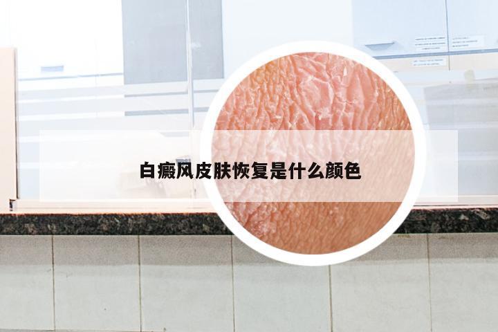 白癜风皮肤恢复是什么颜色