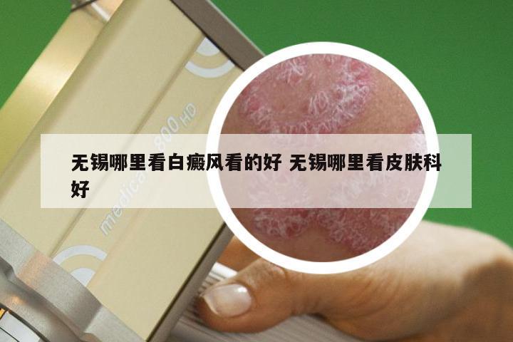 无锡哪里看白癜风看的好 无锡哪里看皮肤科好