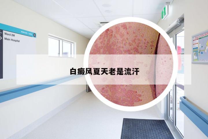 白癜风夏天老是流汗