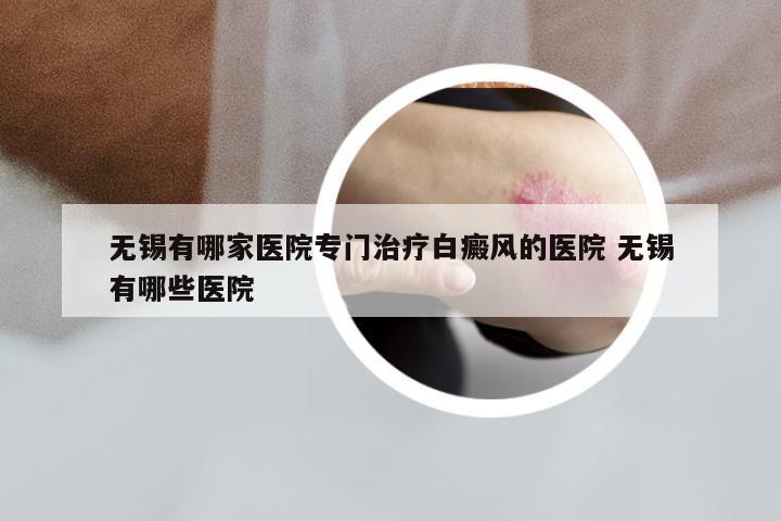 无锡有哪家医院专门治疗白癜风的医院 无锡有哪些医院