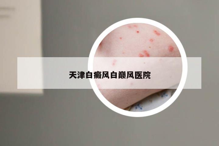 天津白癜风白巅风医院