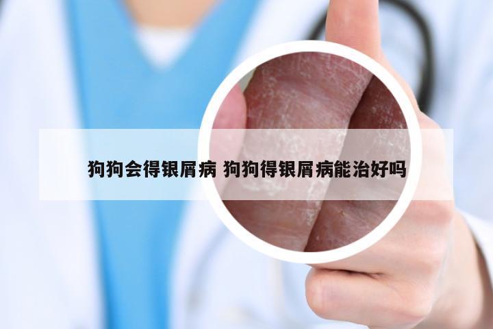 狗狗会得银屑病 狗狗得银屑病能治好吗