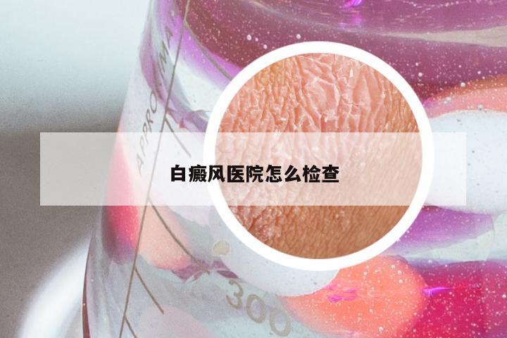 白癜风医院怎么检查