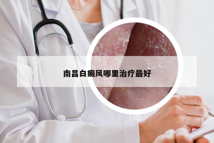 南昌白癜风哪里治疗最好