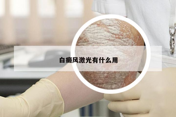白癜风激光有什么用