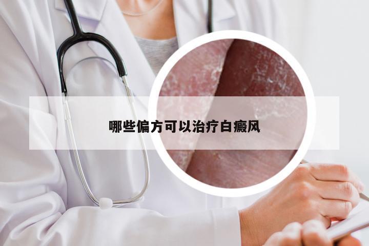 哪些偏方可以治疗白癜风