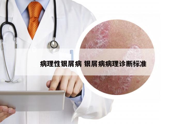 病理性银屑病 银屑病病理诊断标准