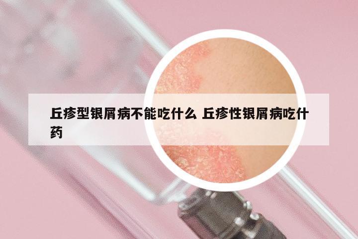 丘疹型银屑病不能吃什么 丘疹性银屑病吃什药