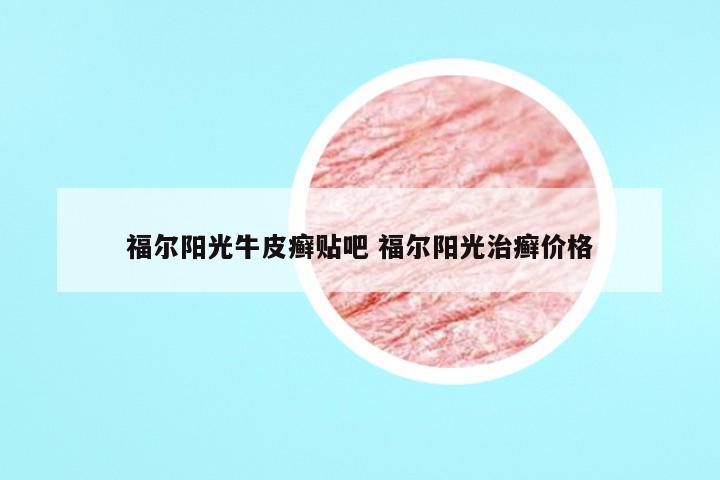 福尔阳光牛皮癣贴吧 福尔阳光治癣价格
