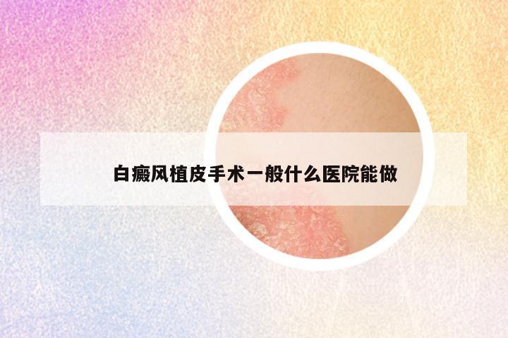 白癜风植皮手术一般什么医院能做